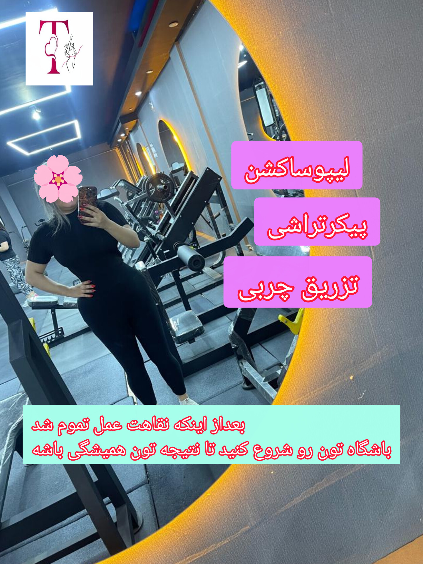 مراقبت های بعداز عمل لیپوساکشن